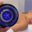 SMART CUPPING HIJAMA THERAPY DEVICE